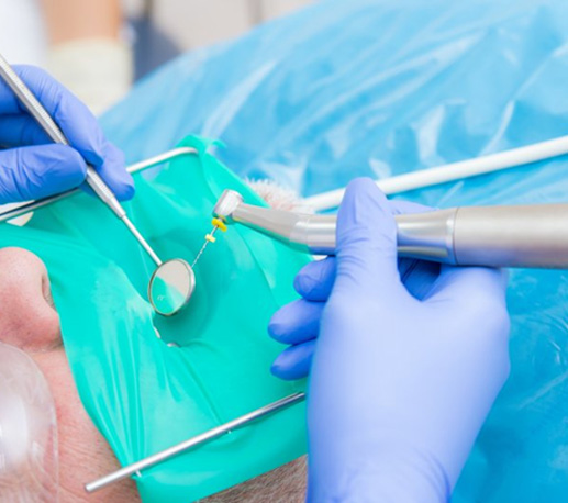 Dentist performing a root canal 