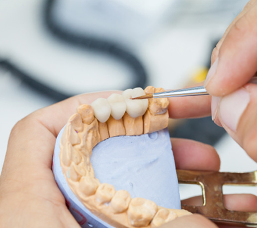 Dental technician working on dental bridge
