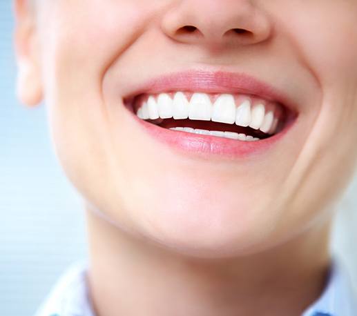 Bright smile after at home teeth whitening treatment