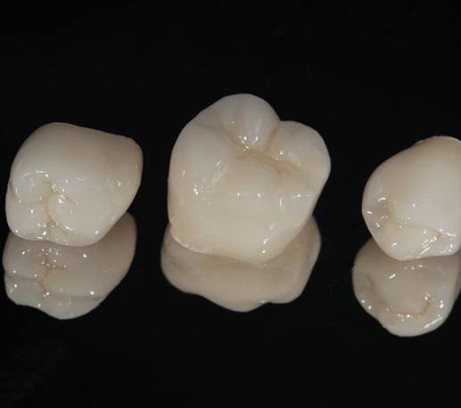 three dental crowns against black background