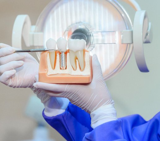 dentist using a dental implant model during a consultation