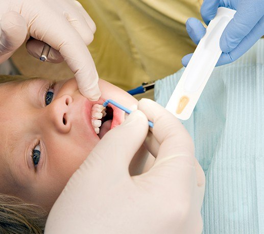 Young boy receiving silver diamine fluoride treatment