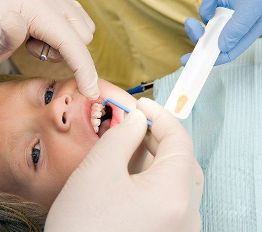 Young boy receiving silver diamine fluoride treatment