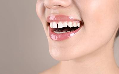 Woman’s smile with gap between front teeth