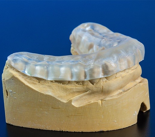 Model smile with occlusal splint